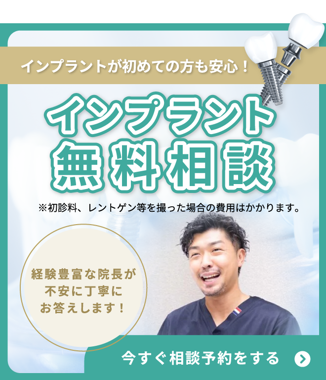 インプラント無料相談のバナー
